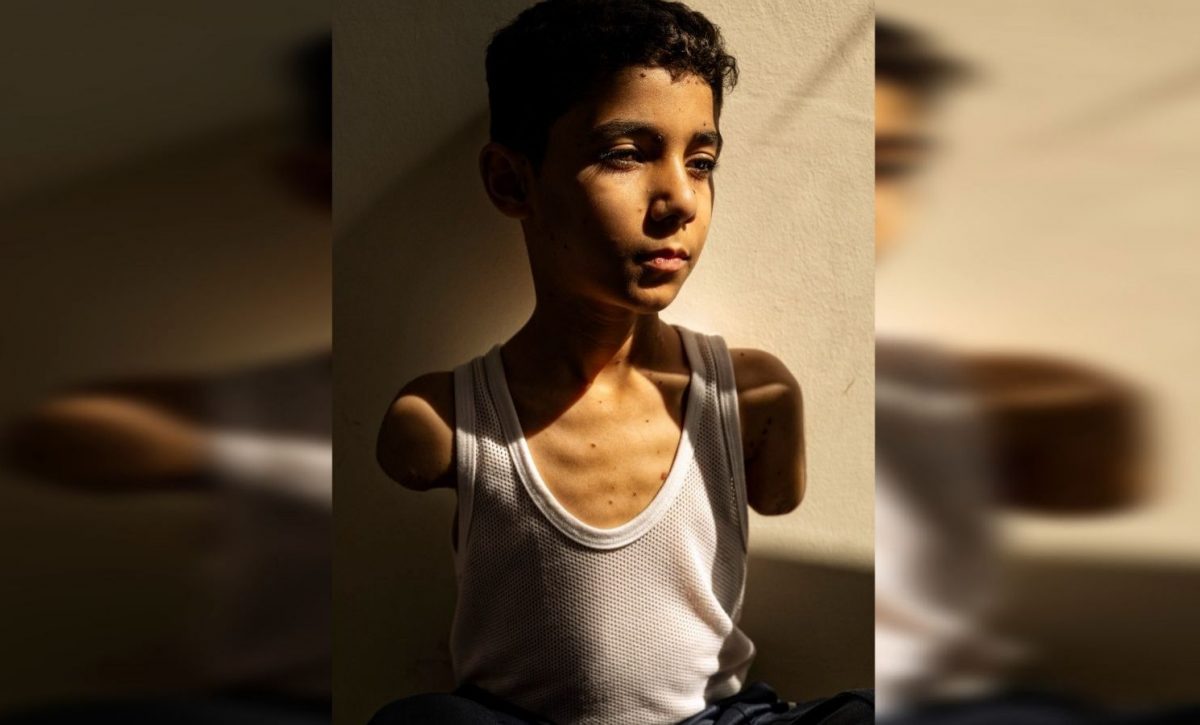 Fotografía de niño mutilado en Gaza gana el World Press Photo 2025