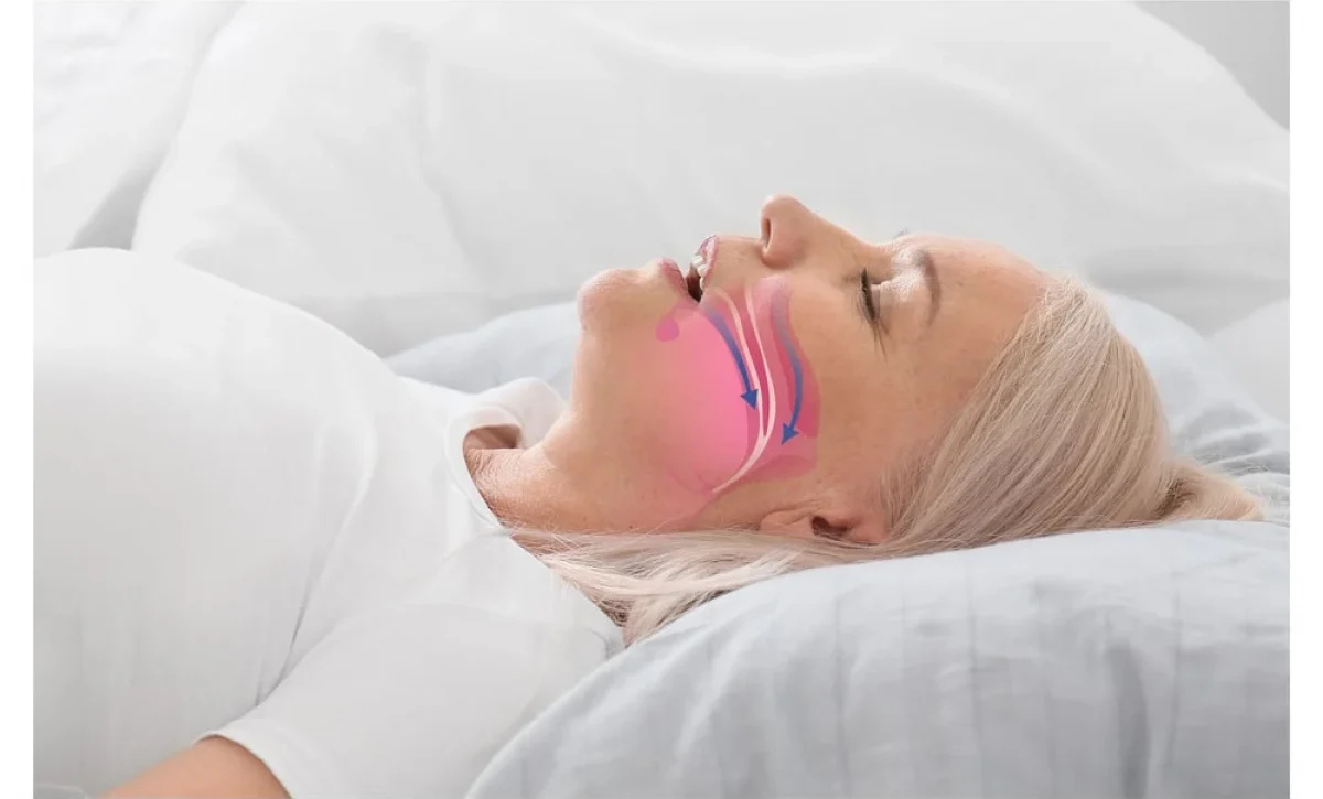 ¿Sufres de cansancio al despertar? Podrías tener apnea. Conoce los síntomas y la importancia del diagnóstico temprano.