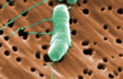 Luisiana reporta cinco muertos por brote de bacteria carnívora en 2025