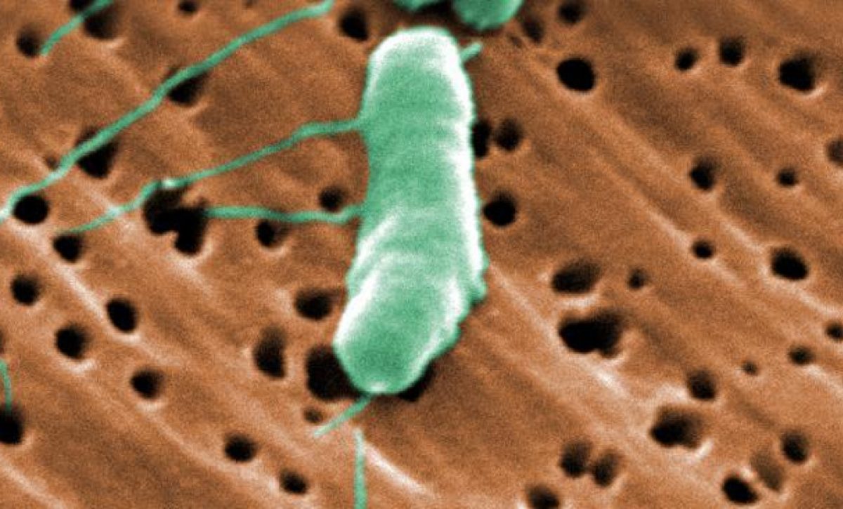 Luisiana reporta cinco muertos por brote de bacteria carnívora en 2025