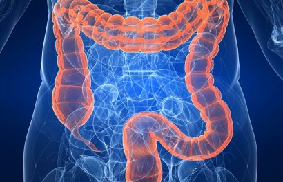 Tratamiento menos invasivo contra el cáncer de recto logra resultados comparables con la cirugía radical