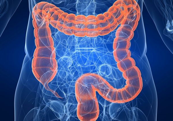 Tratamiento menos invasivo contra el cáncer de recto logra resultados comparables con la cirugía radical