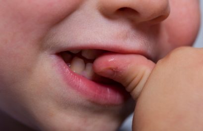 Cinco métodos eficaces para que los niños dejen de comerse las uñas