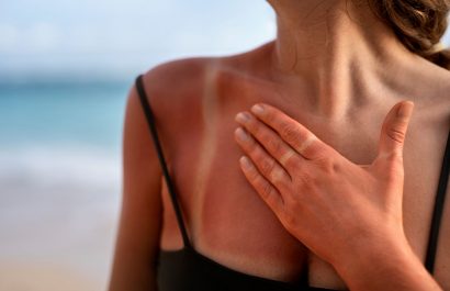 Alertan que broncearse daña la piel y eleva el riesgo de cáncer cutáneo