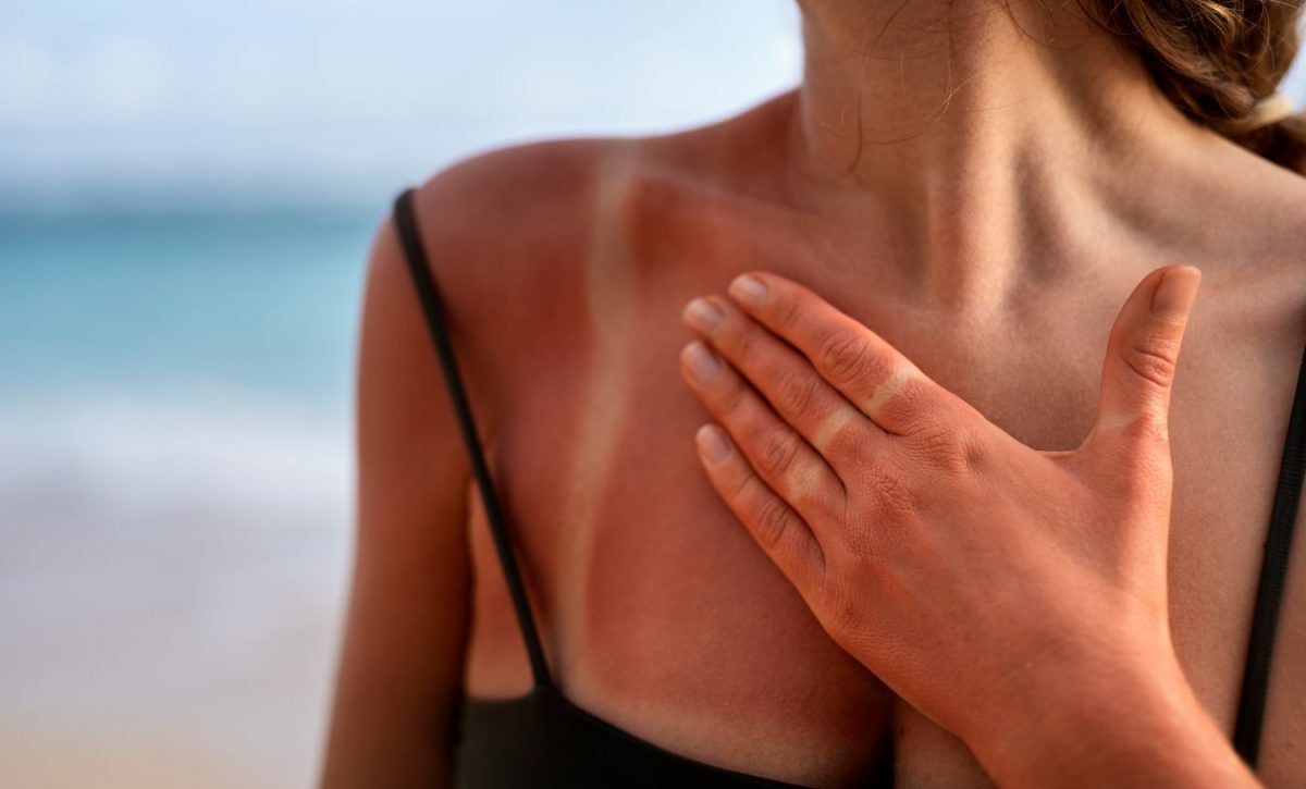 Alertan que broncearse daña la piel y eleva el riesgo de cáncer cutáneo
