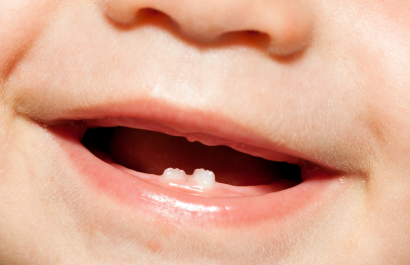 ¿Sabías que los dientes de leche afectan la salud permanente? Aprende cómo cuidarlos