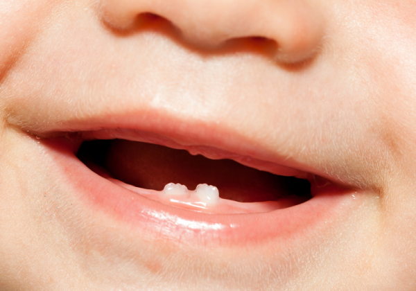 ¿Sabías que los dientes de leche afectan la salud permanente? Aprende cómo cuidarlos