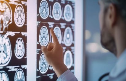 Este alimento común podría estar vinculado al Parkinson, según la ciencia