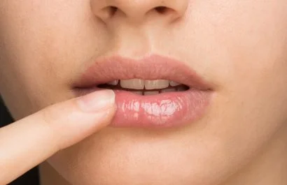 Dermatología advierte sobre el uso inadecuado del peeling labial en casa