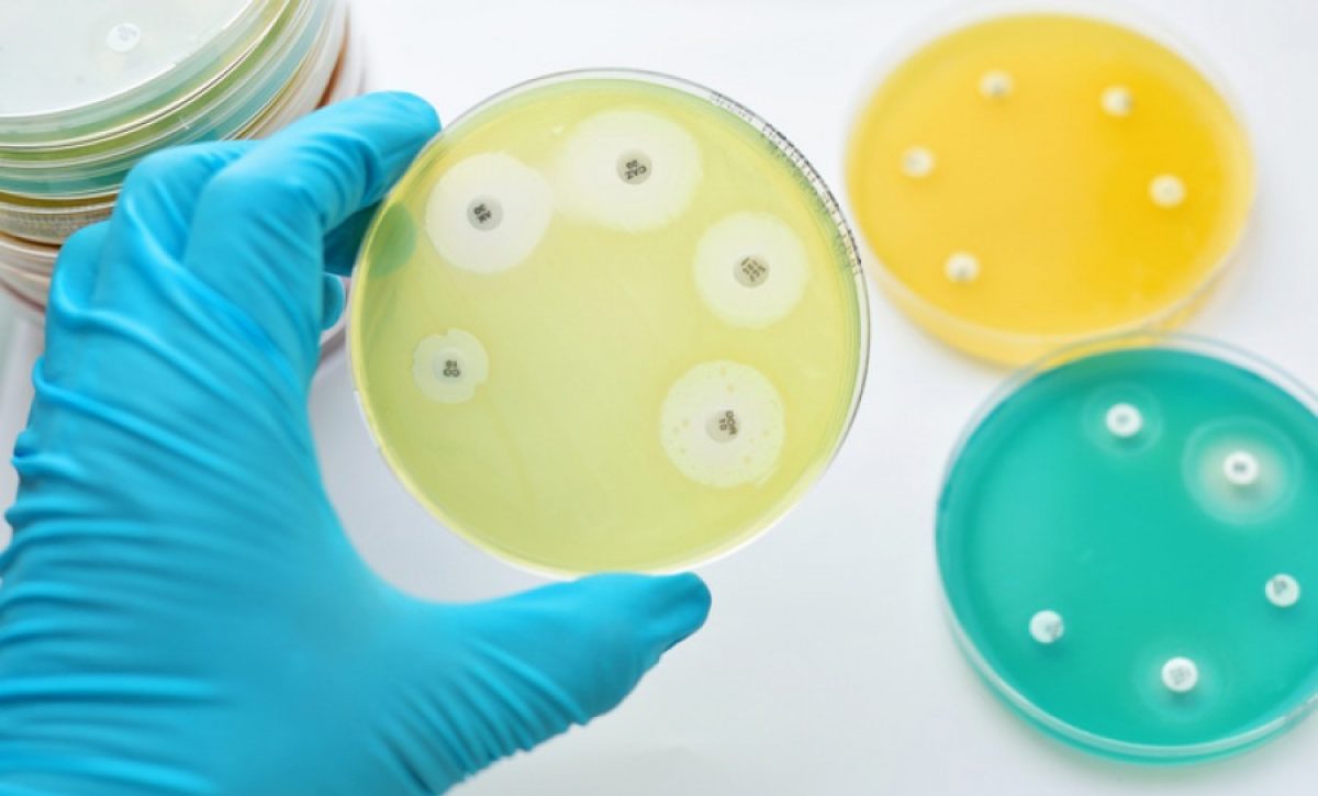 Bacterias que no mueren: El peligro oculto de la resistencia a los antibióticos por su mal uso.