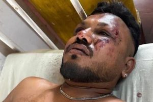 Solo una persona sobrevive entre 242 pasajeros del avión de Air India