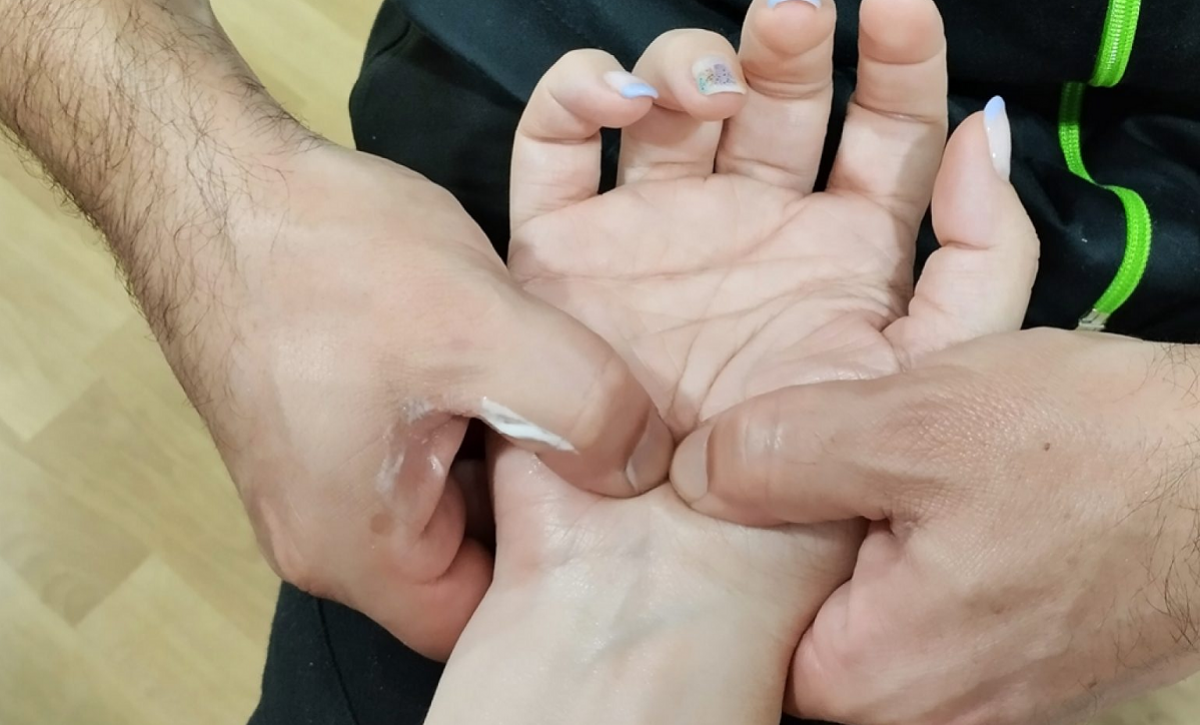 ¿Dolor, hormigueo o entumecimiento en las manos? Podrías tener síndrome del túnel carpiano