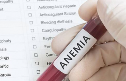 ¿Estás cansado todo el tiempo La anemia podría ser la razón