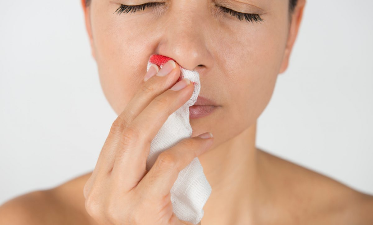 ¿Por qué sangra tu nariz? Descubre causas y trucos preventivos